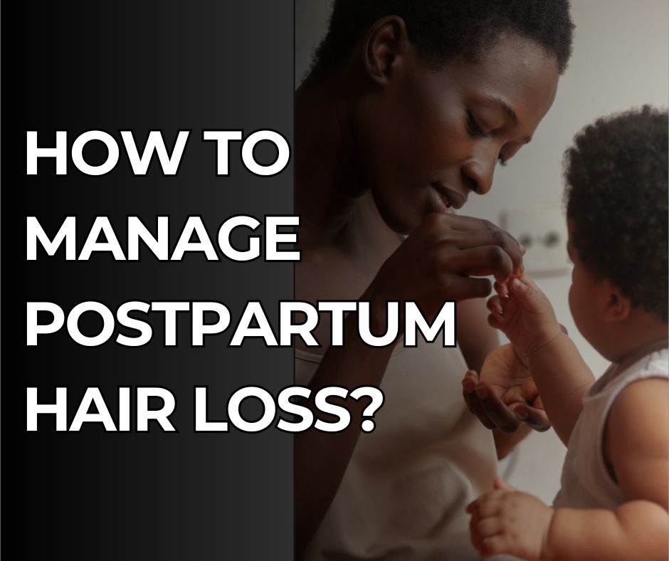 How to manage postpartum Hair Loss?