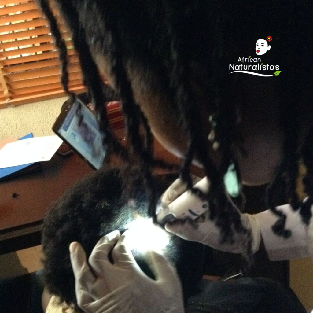 African Naturalistas trichologist performing a trichoscopy 