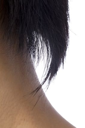 An image of breakage of the nape hair 